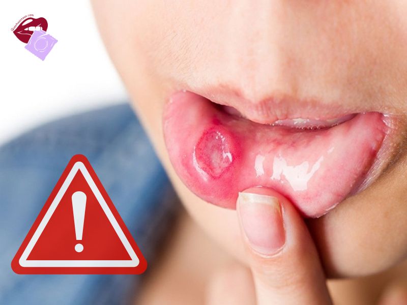 Không đeo sẽ gây ra nhiều tác hại khi Oral Sex