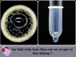 Bao cao su có gai có đau không