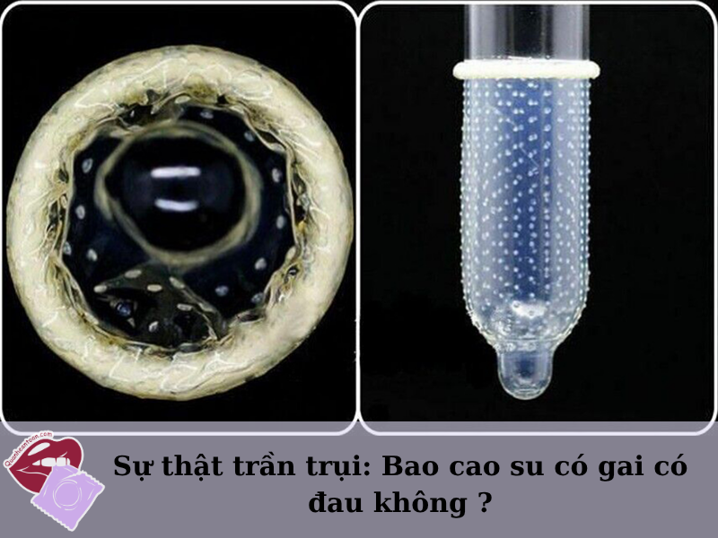 Bao cao su có gai có đau không