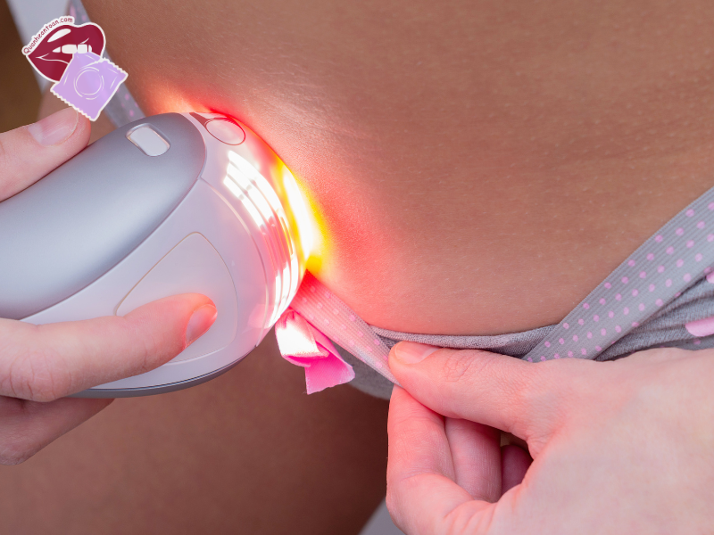 Có nên triệt lông vùng kín không?